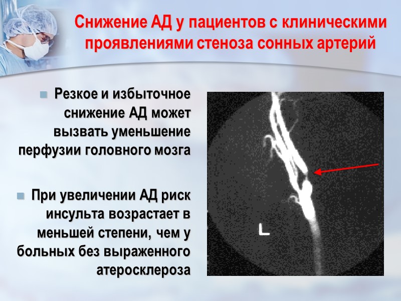 Снижение АД у пациентов с клиническими проявлениями стеноза сонных артерий Резкое и избыточное снижение